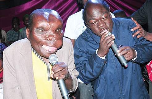 The 15-Year-Old Boy with the Body of an Old Man: 10 People Who Look Like Real-Life Aliens