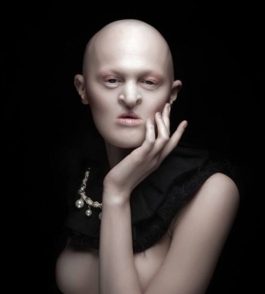 The 15-Year-Old Boy with the Body of an Old Man: 10 People Who Look Like Real-Life Aliens