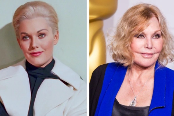 TOP 10 Hollywood Celebs Whose Faces Were Ruined by Plastic Surgery—You Won’t Recognize Them!